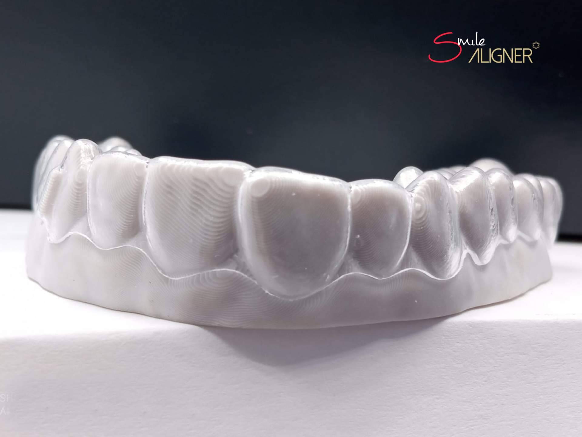 Smile Aligner es la ortodoncia invisible exclusiva de Clínicas Hernadent
