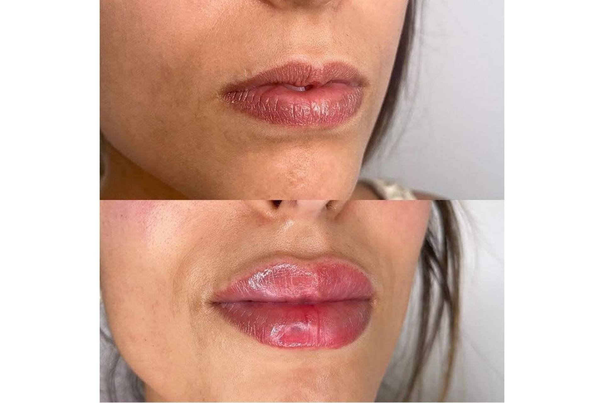 El doctor Castellar ofrece tratamientos estéticos con los que se consigue revitalizar la expresión facial de mujeres y hombres