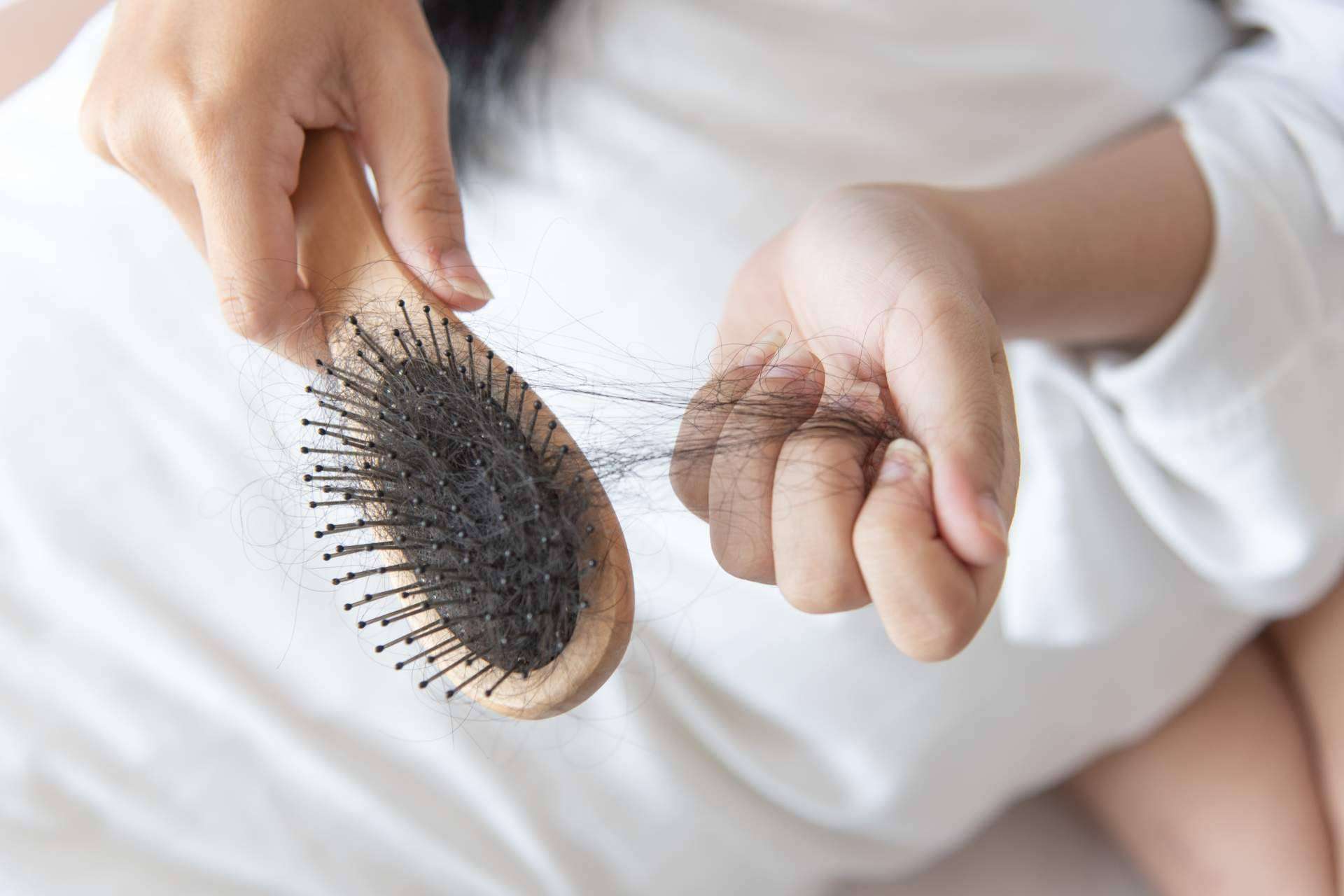 ¿Cómo remediar la caída de pelo hormonal o carencial con el tratamiento efectivo de Géomer?