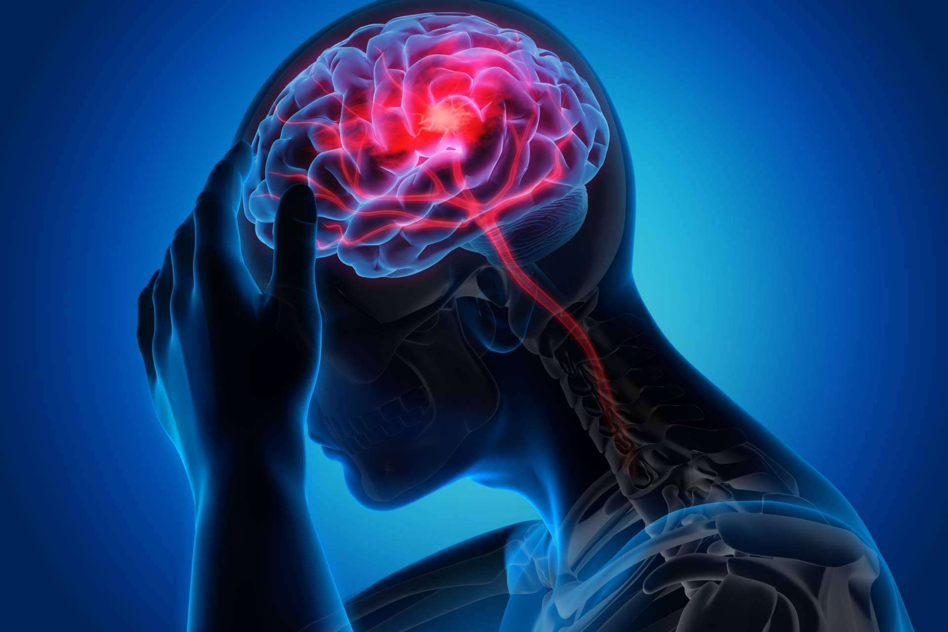 Clínica Viasalud: fisioterapia para aliviar las migrañas