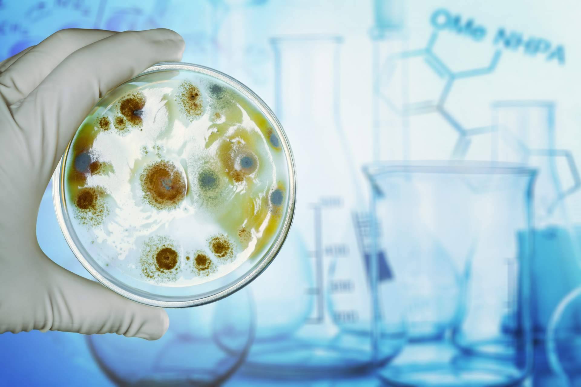 Entrevista al director de la unidad de microbiota intestinal UMEBIR: Dr. Fernando Ruger Viarengo