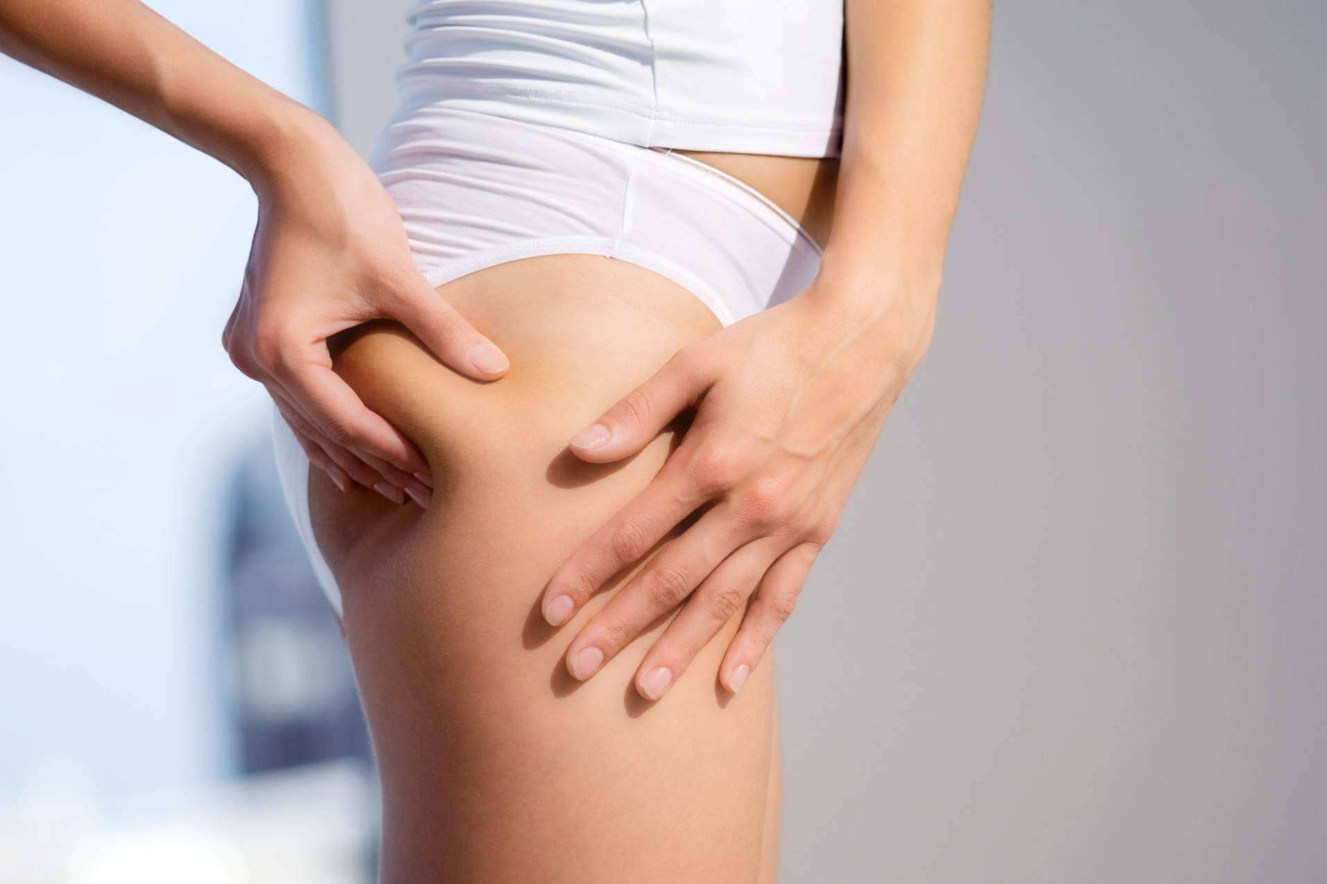 Combatir la celulitis de una forma natural es posible con Sincelut Forte