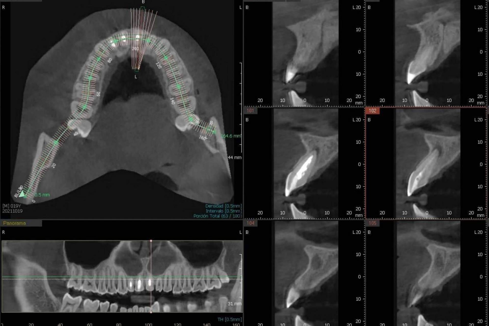 El innovador CBCT dental 3D que ofrece la Clínica Blay+Monzó
