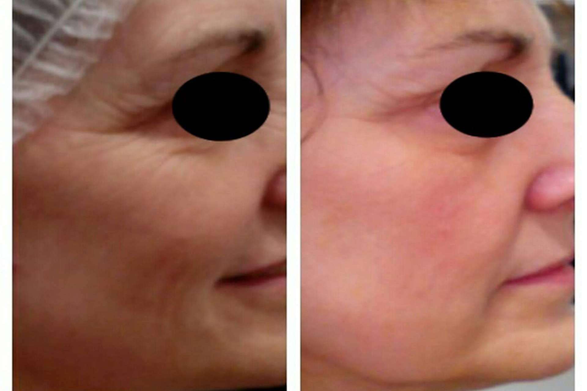 Tratamiento facial antimanchas para conseguir una piel de porcelana y otros tratamientos faciales icónicos de la compañía MiCleo&Co