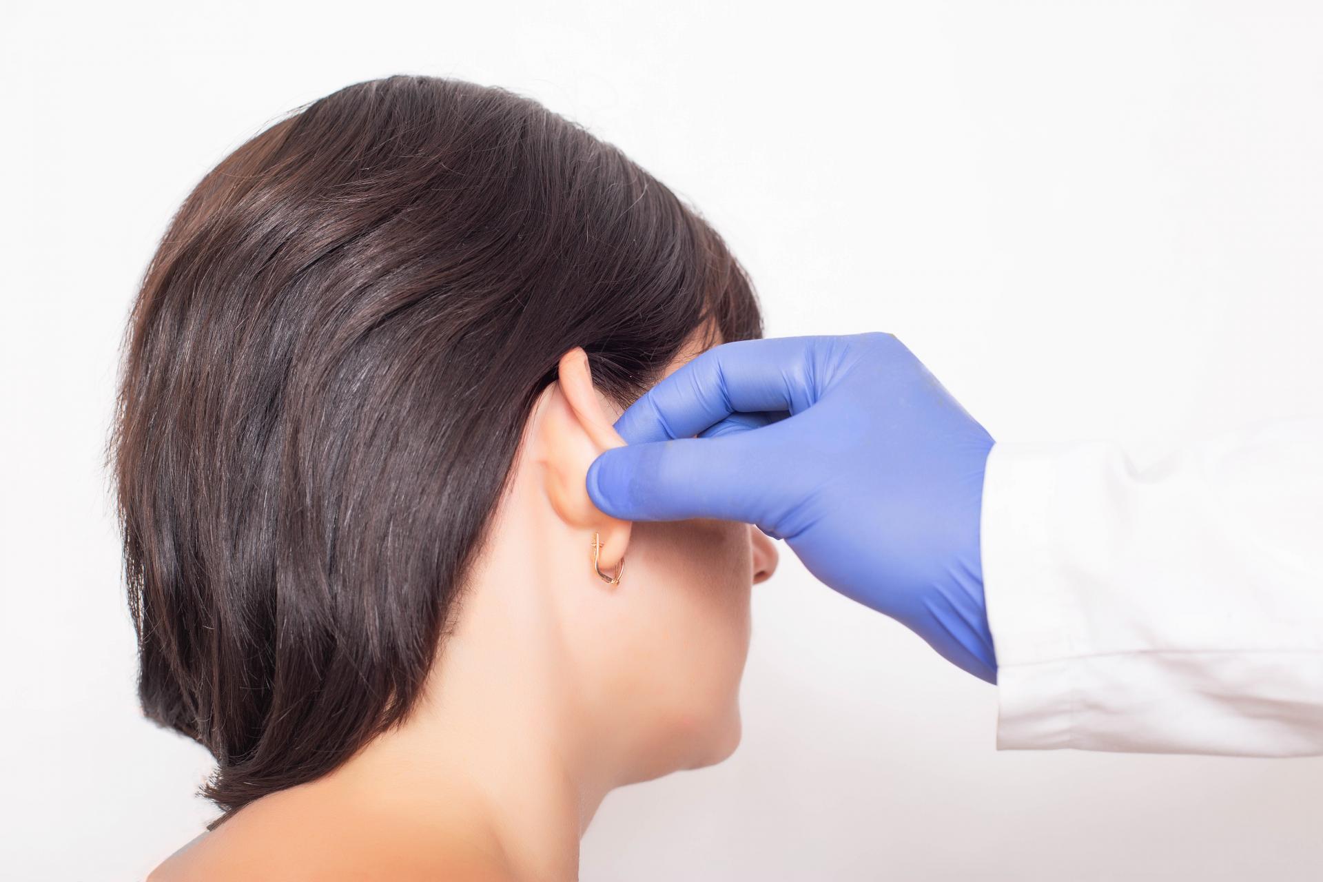 Otoplastia, una cirugía mínimamente invasiva realizada por el Doctor Beltrán
