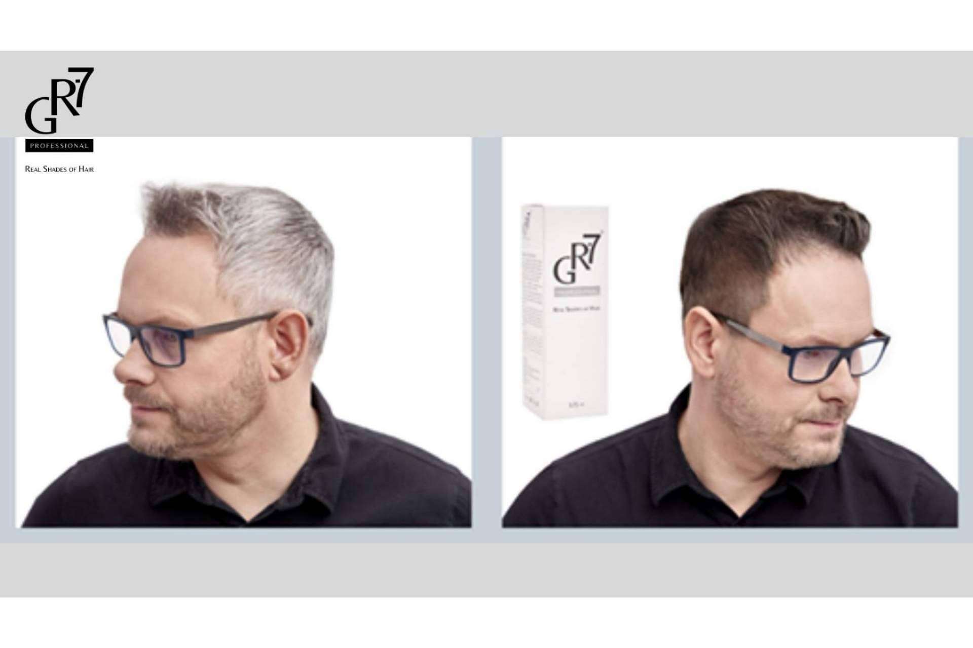 GR-7 Professional, la fórmula para estimular la producción de melanina y que desaparezcan las canas