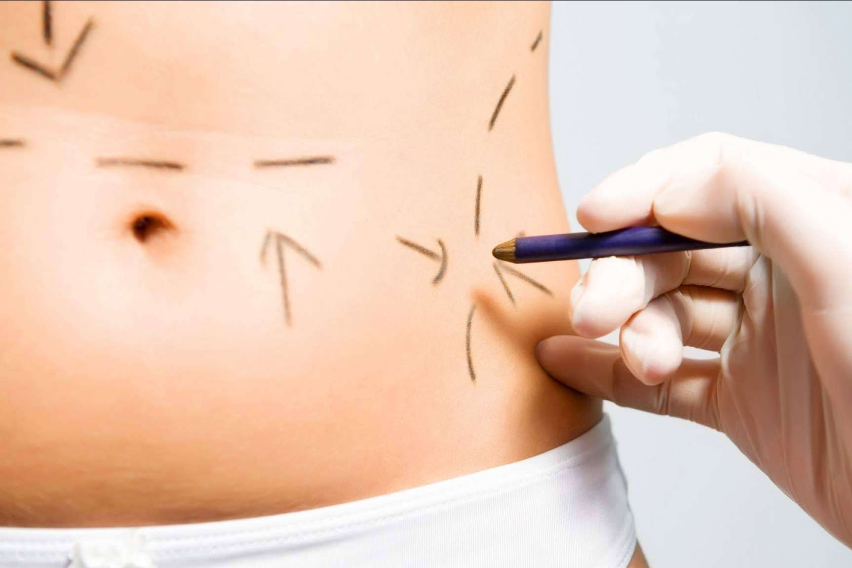 Lucir un cuerpo de ensueño gracias a la cirugía estética corporal de Clínicas Be
