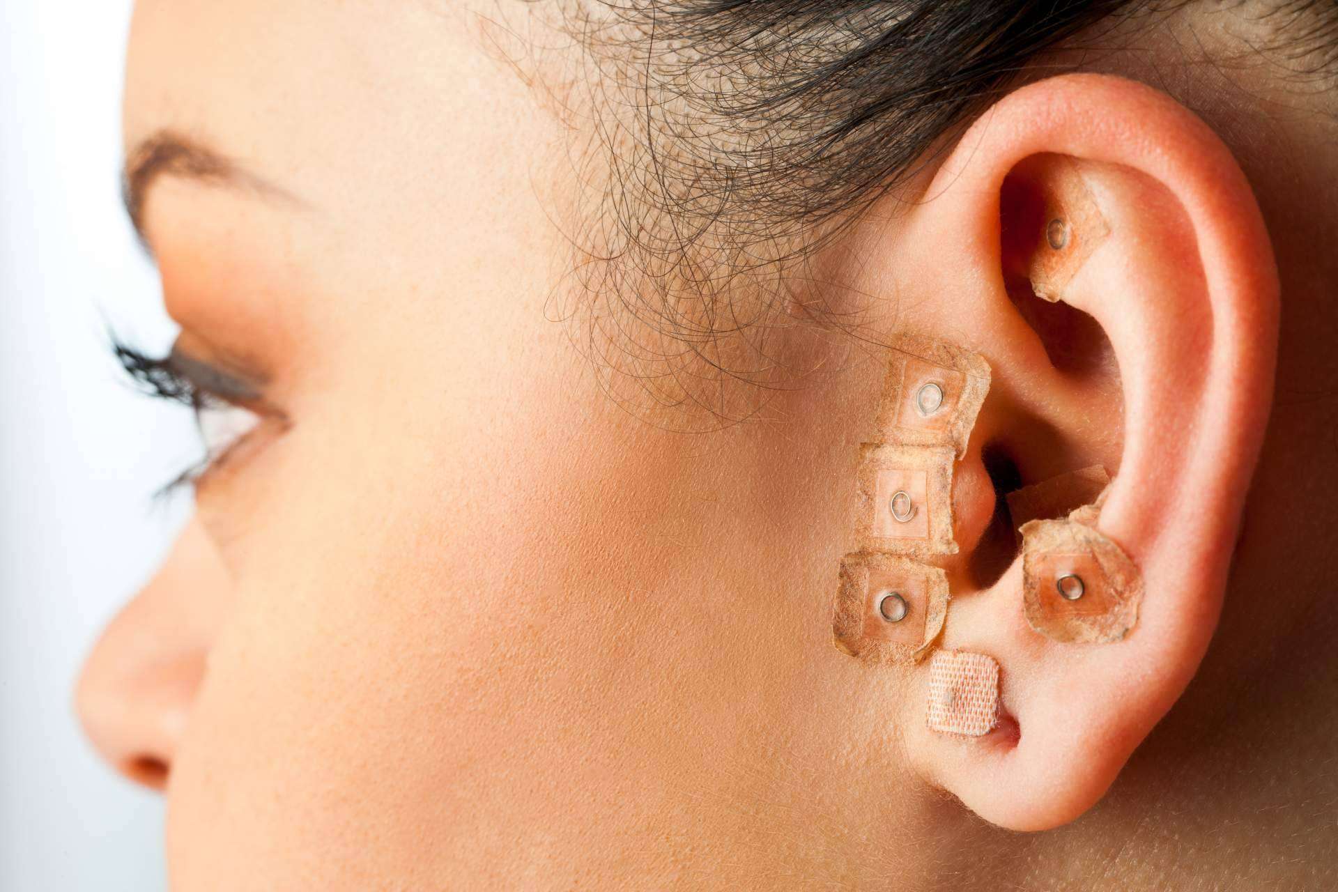 Auriculoterapia, la técnica natural coadyuvante en el tratamiento del dolor, ansiedad y adicciones de Rambla 6