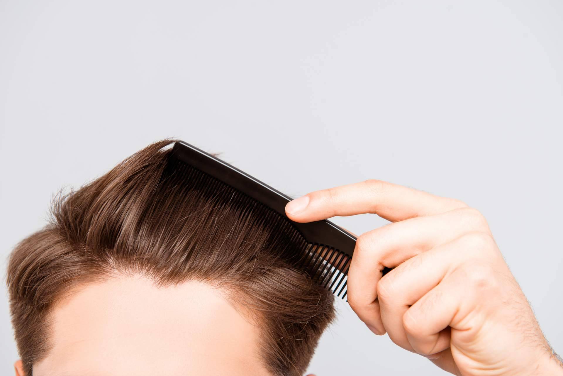 Nanofat, el tratamiento capilar de Clínica Tarrazo que pone fin a la alopecia