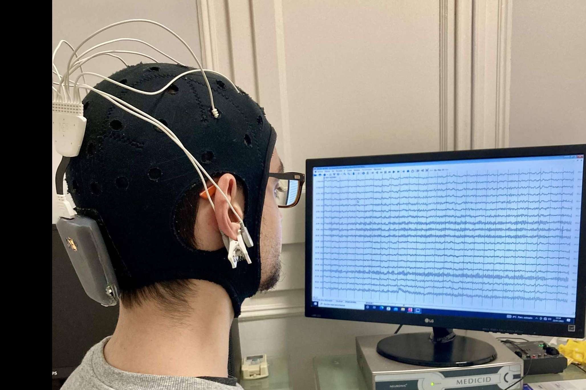 Recuperación tras sufrir un ictus gracias a los tratamientos de neuromodulación