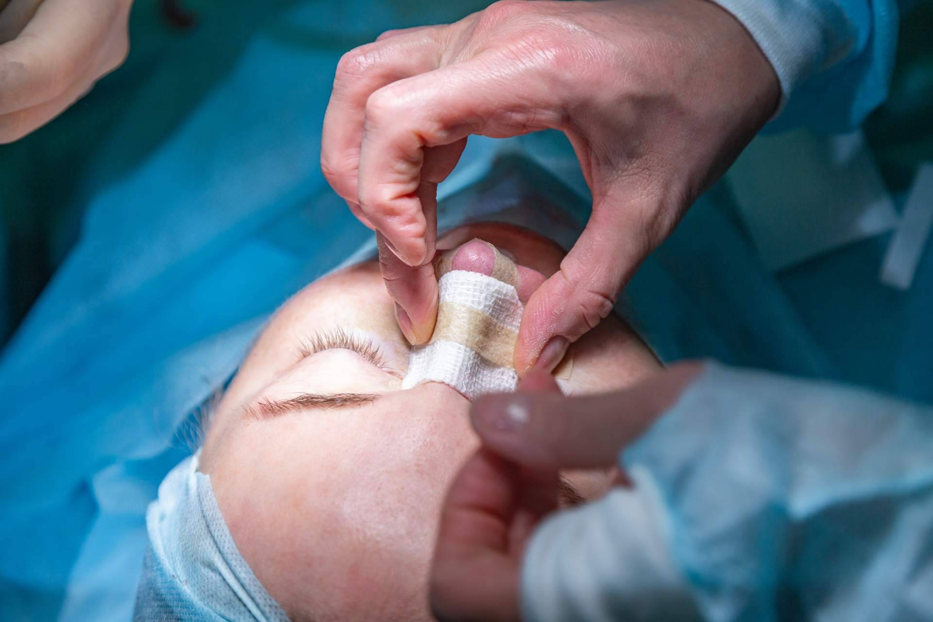 Tratamientos de rinoplastia ultrasónica y cirugía plástica para la nariz con Model Bell