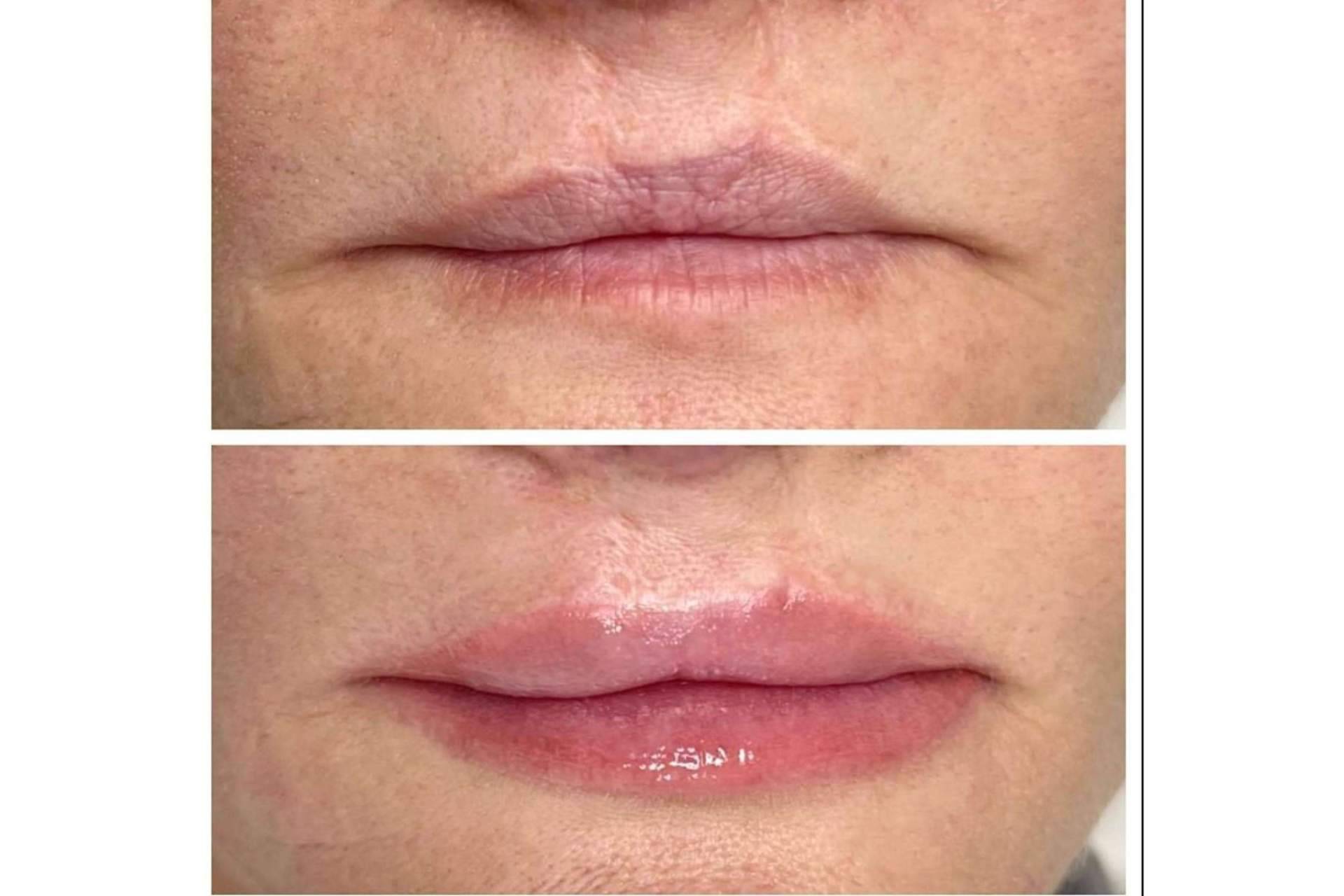 RL Clinic y su amplia experiencia en la industria de la medicina estética