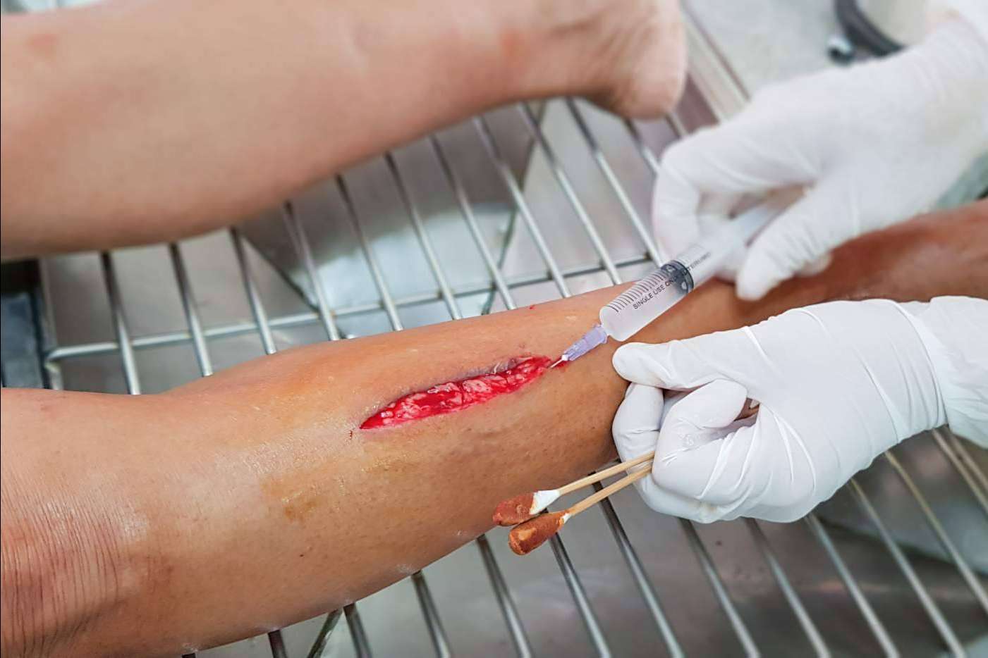 Enfermería Evidente hará una formación gratuita sobre sutura online para profesionales sanitarios el próximo 6 de Febrero de 2023