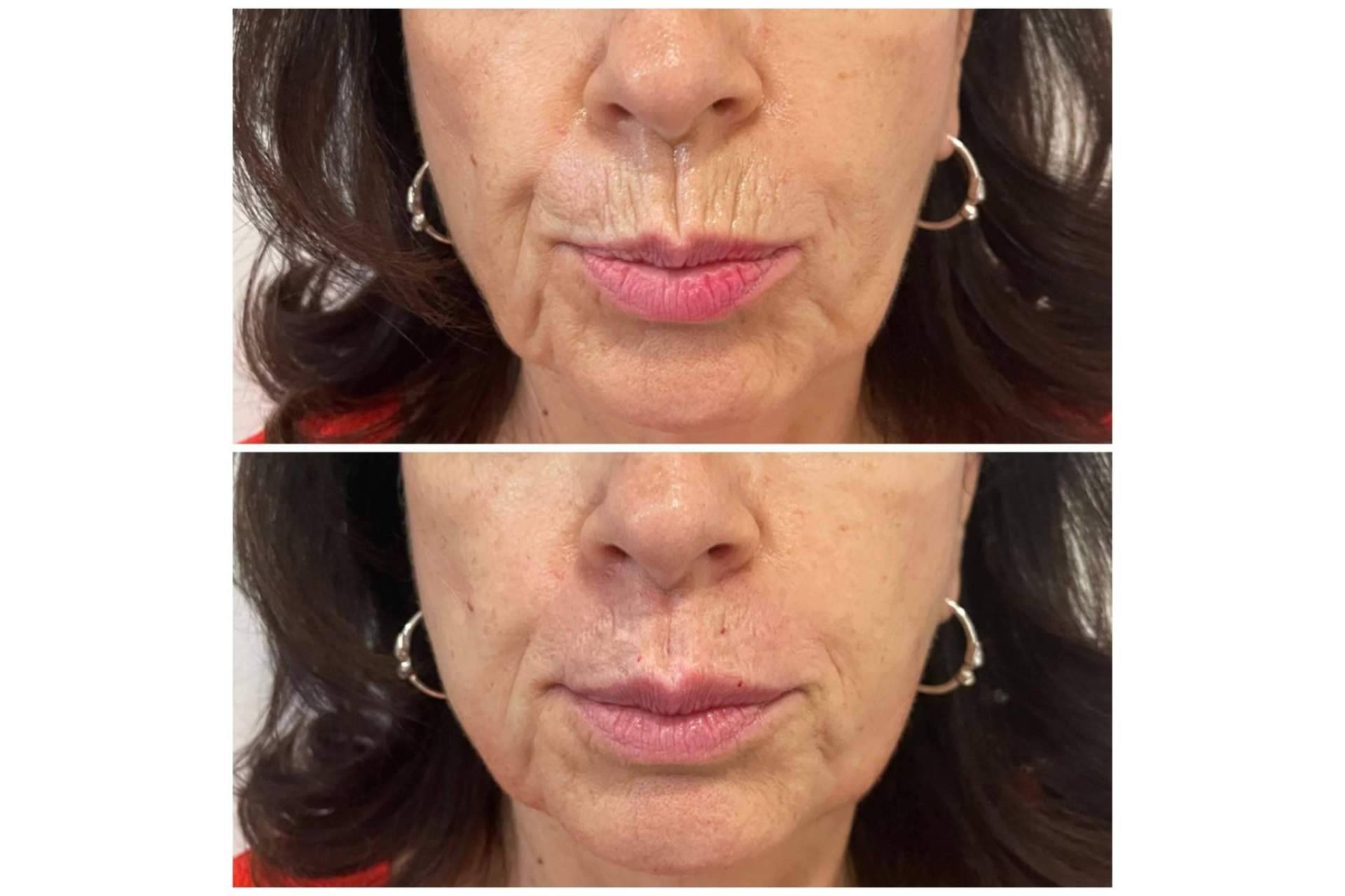 Cecilia Arthur, la clínica estética especializada en blanching