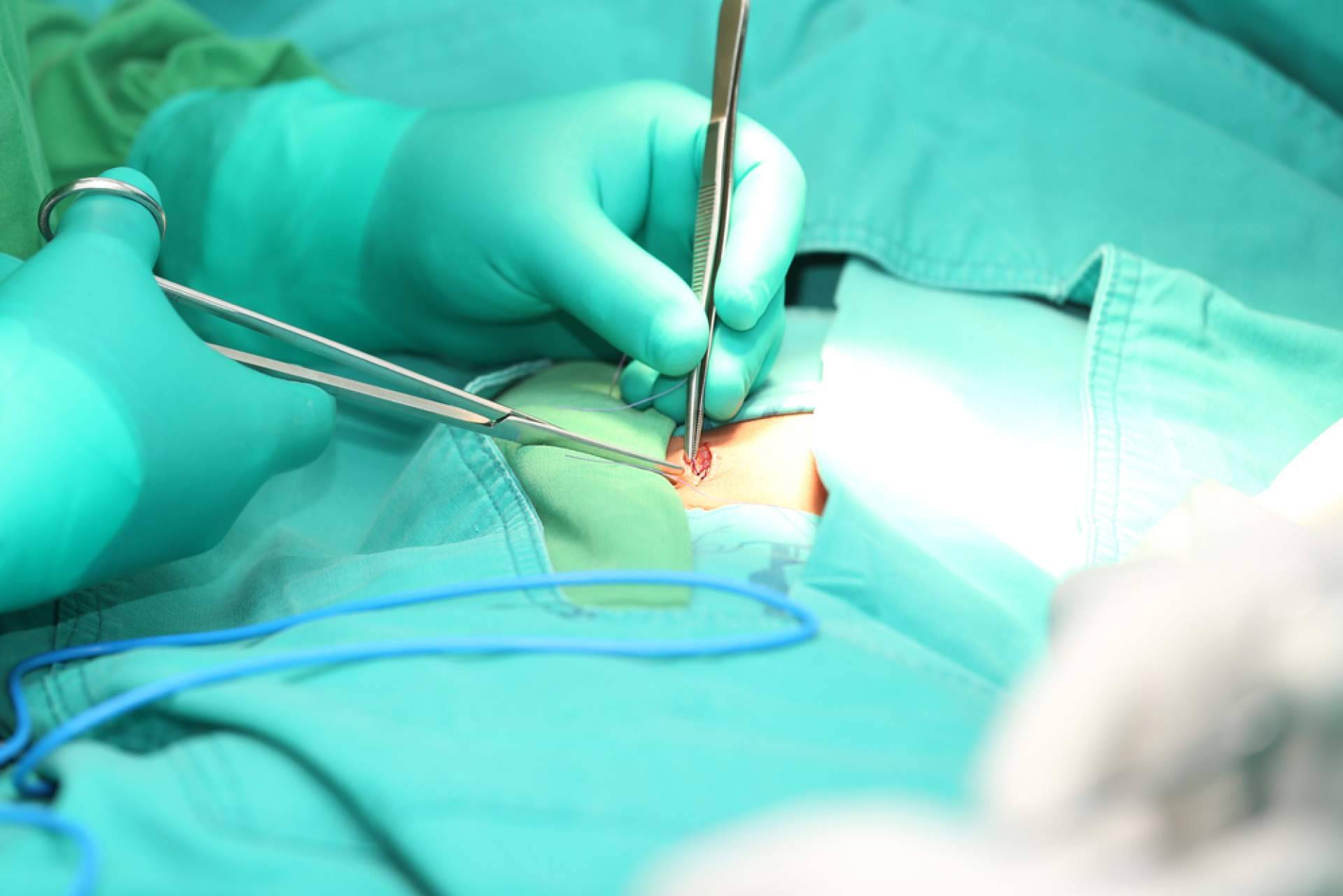 Acerca de la cirugía de hernia inguinal, resolver dudas de la mano del Dr. Javier Martínez Pascuas