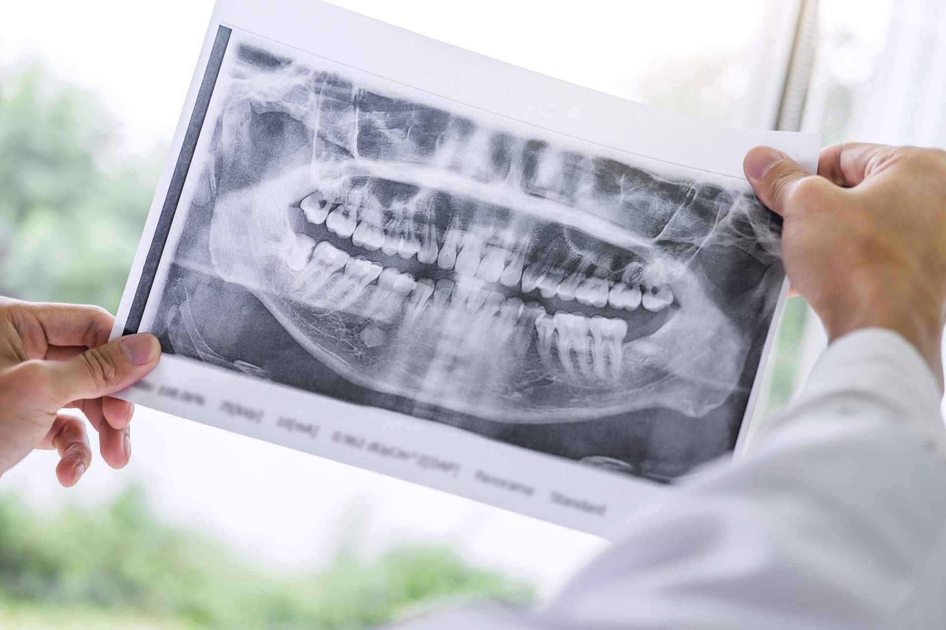 10 motivos para buscar un maxilofacial para la boca