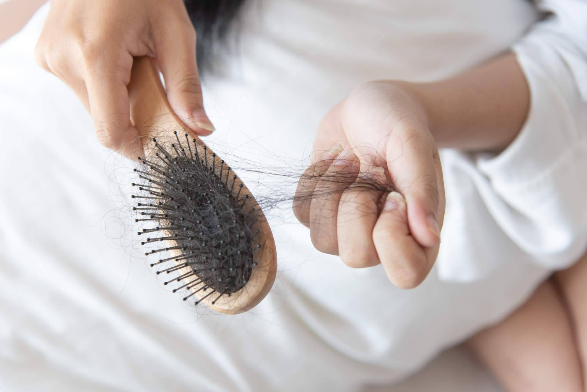 Evocapil ayuda a prevenir la pérdida de cabello