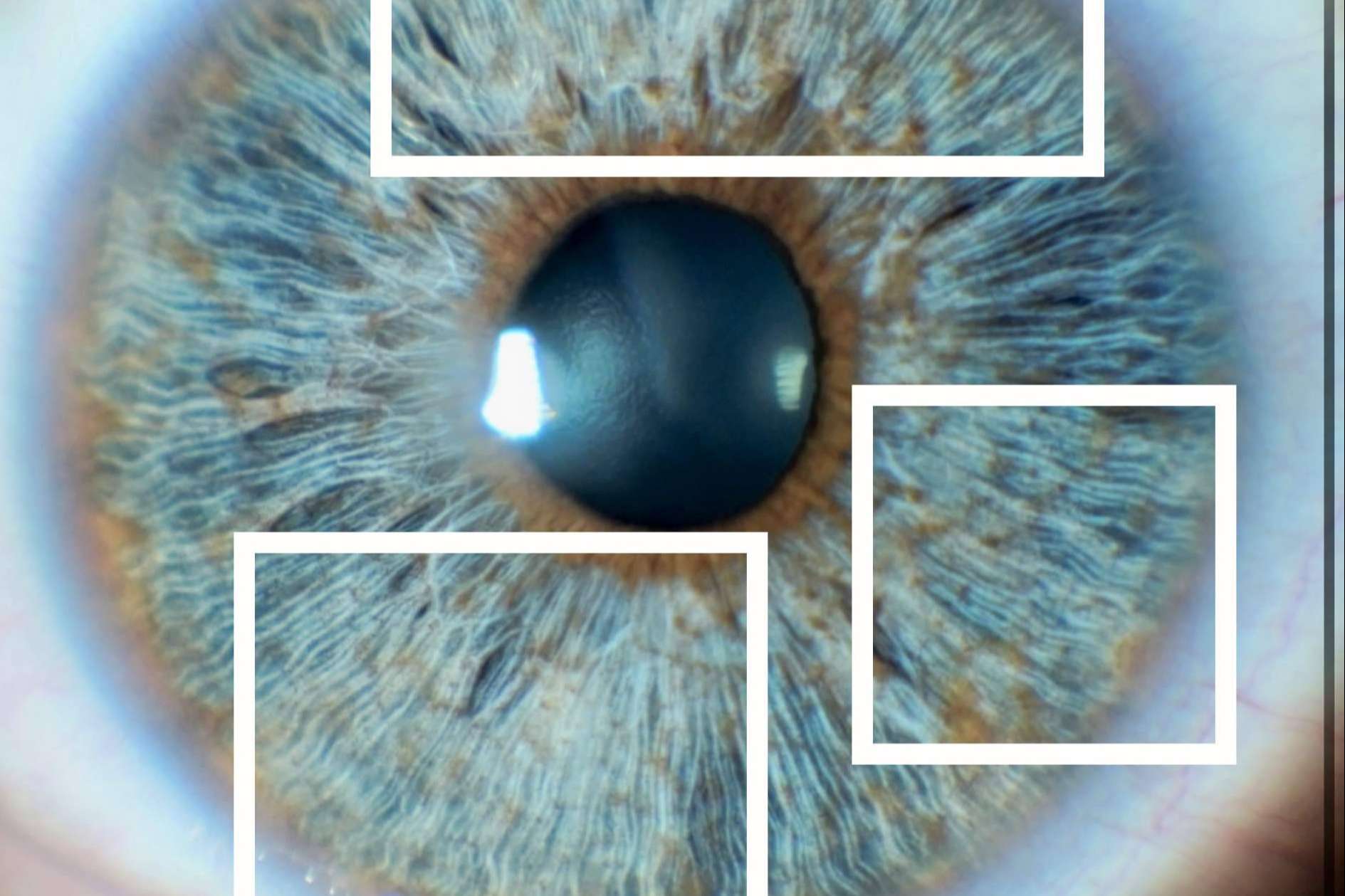 Cómo afecta al brillo de los ojos el colágeno del iris