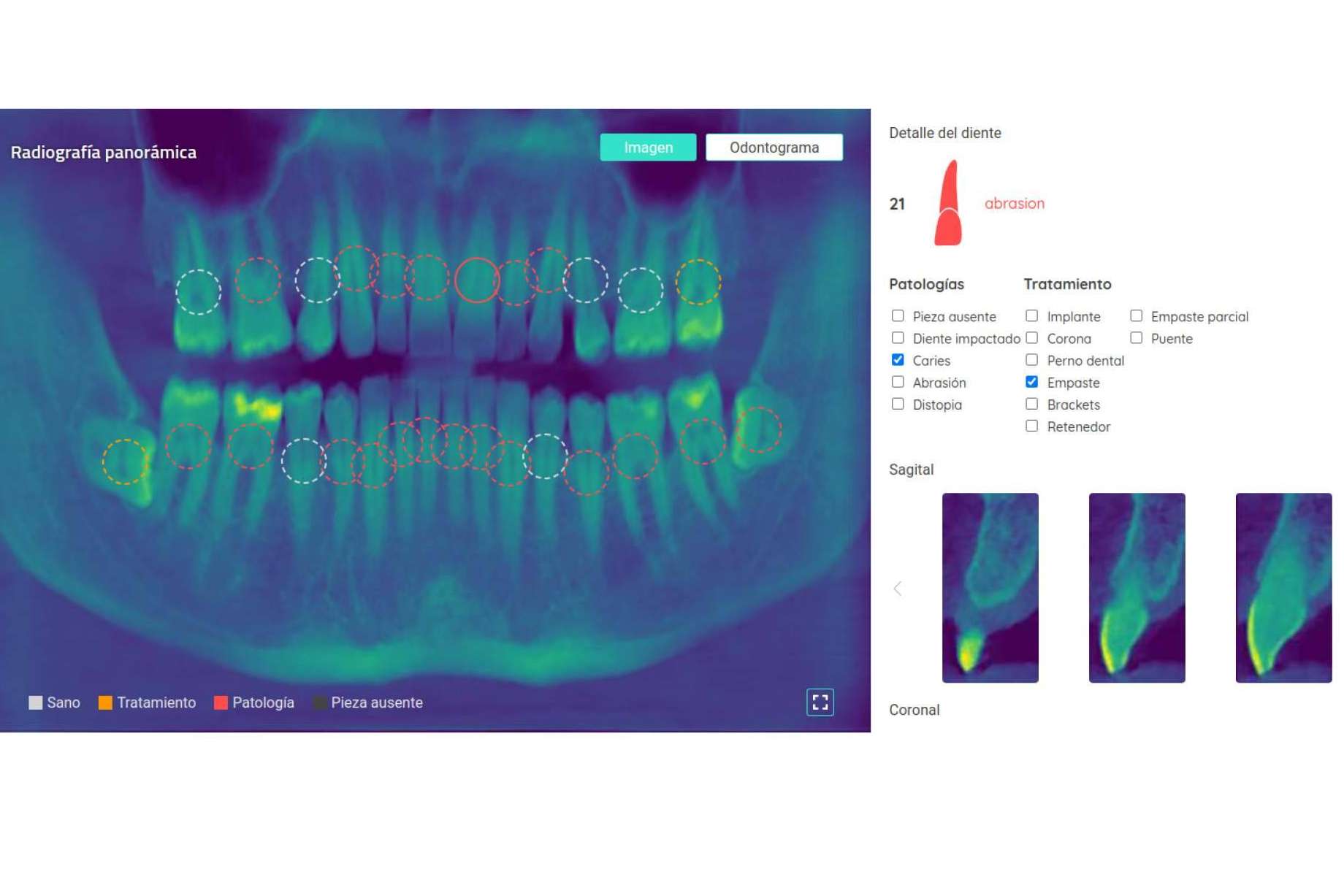 ¿Cómo es el uso de la visión artificial en el mundo odontológico?, por Dentomo