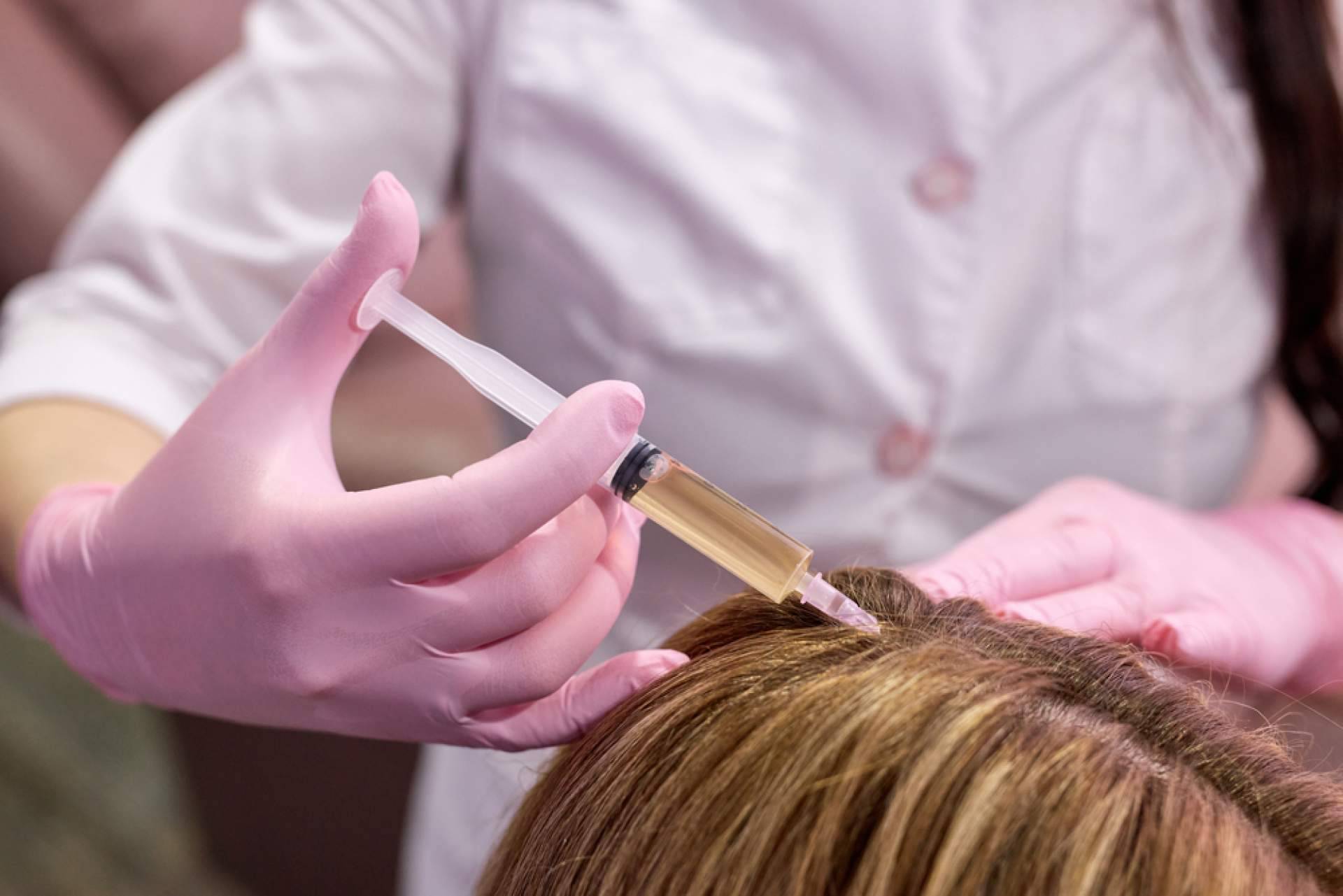 ¿Cómo solucionar la alopecia difusa femenina capilar?, con Capilar Innovation Clinic By Doctor Jesús Aníbal Mora