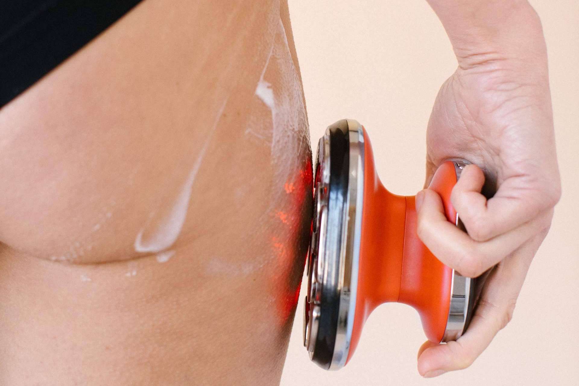 Ventajas de la radiofrecuencia facial y corporal, por Masderm