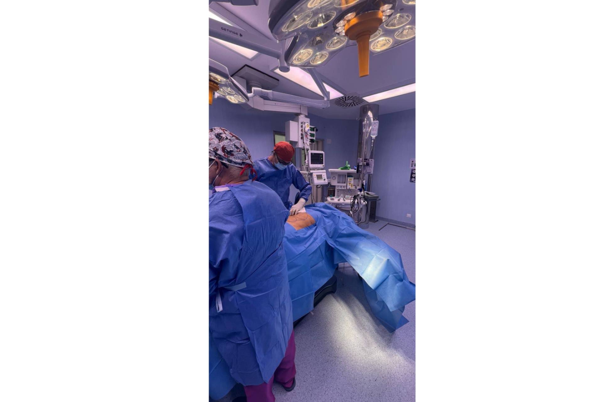 DEA Clínicas ofrece una técnica pionera de lipoescultura y aumento glúteos con resultados precisos