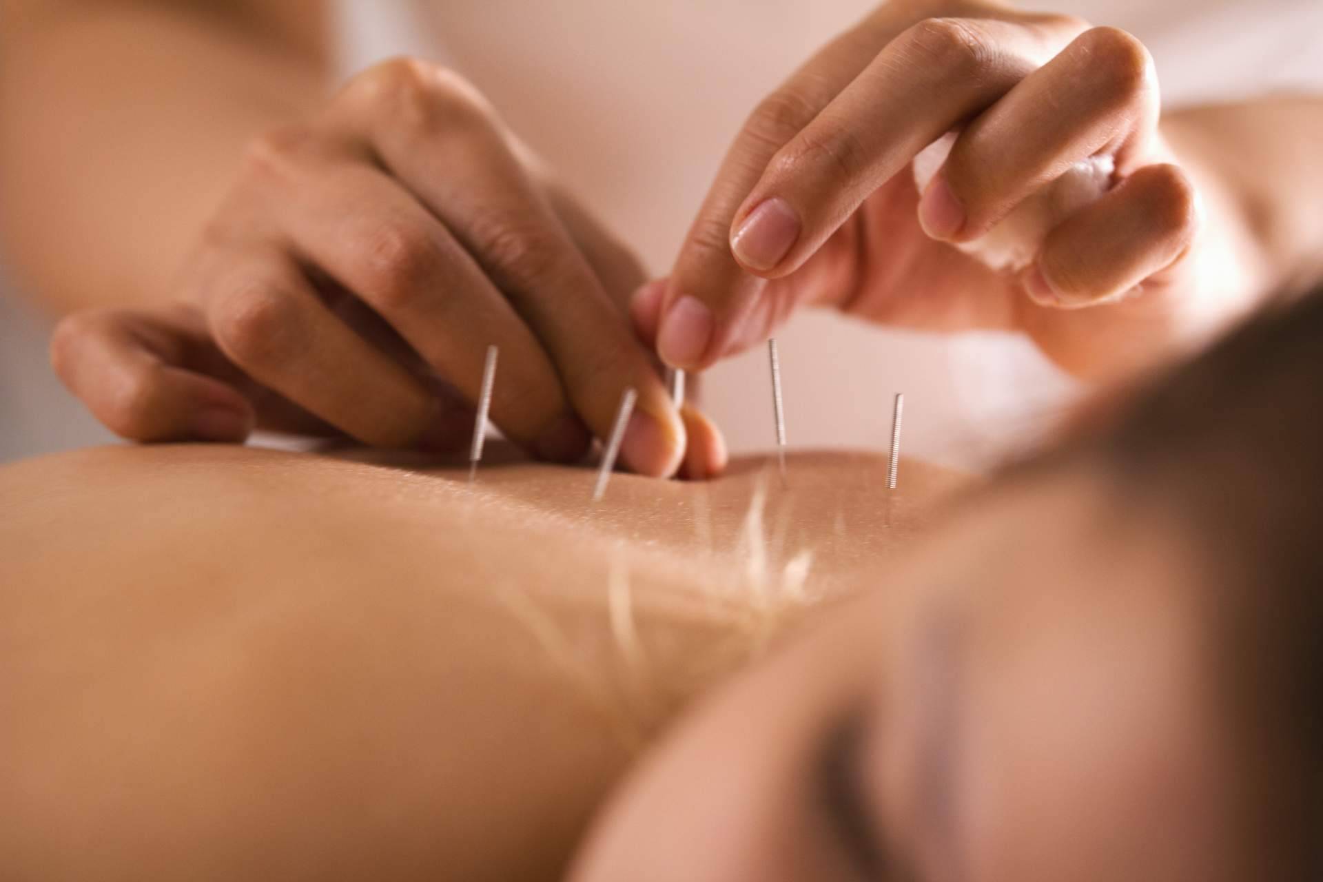 Vital Balance, una clínica de referencia en acupuntura en Málaga