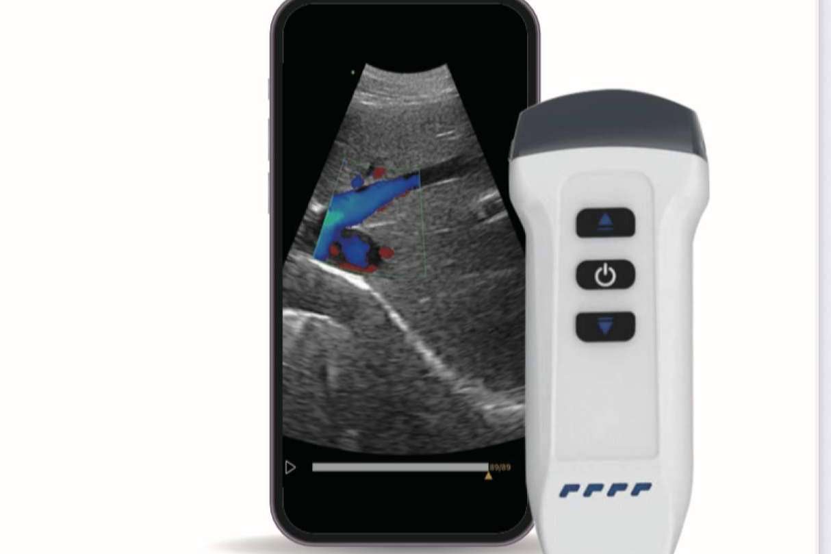 SCPmedical y Dawei impulsan en España la venta de ecógrafos portátiles con visualización en tablet y móvil