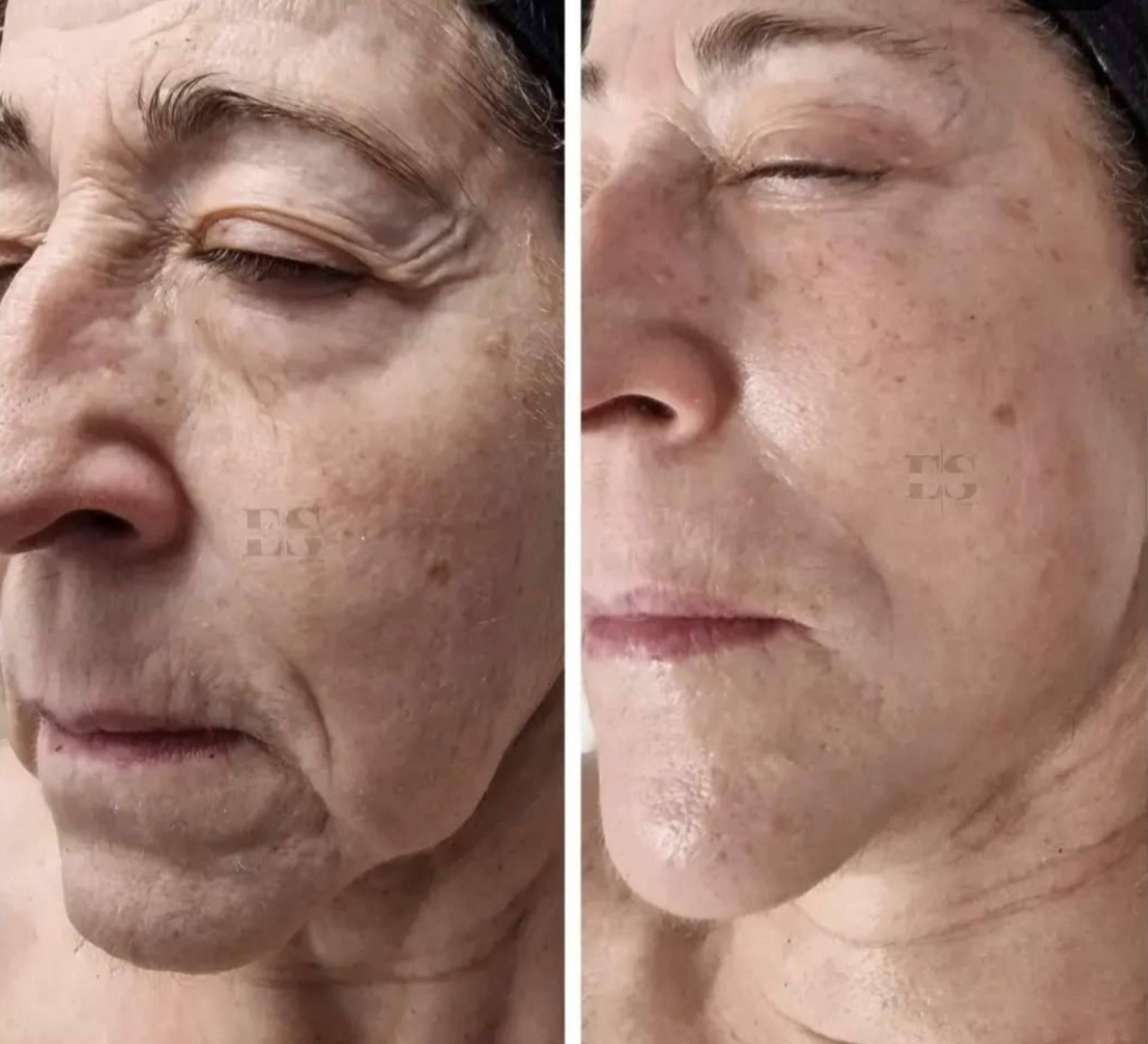 Estética Elena Santos impulsa un concepto integral de belleza con tratamientos personalizados